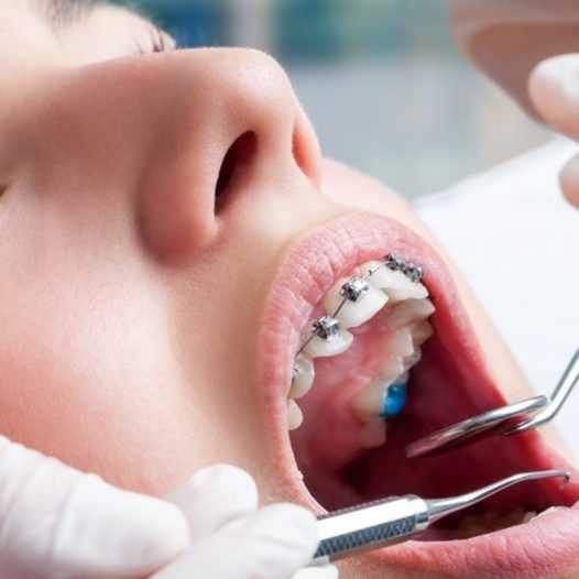 Máster de Formación Permanente en Ortodoncia, un referente en el ámbito de la Odontología, baja su precio para llegar a más gente